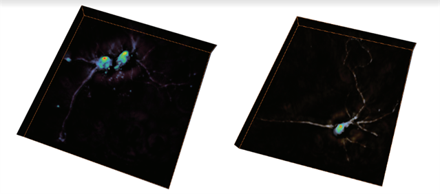 Image of neuron tomograph