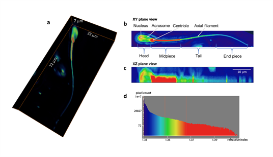 Sperm cells graphed.
