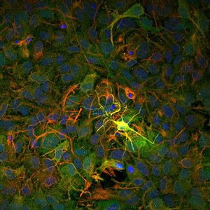 A neuron glowing surrounded by astrocytes.
